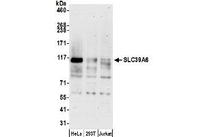 anti-Solute Carrier Family 39 (Zinc Transporter), Member 6 (SLC39A6) (AA 100-150) antibody