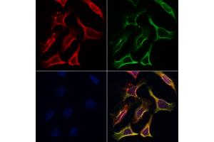 ABIN6265555 and ABIN6266853 staining Hela by IF/ICC. (Transglutaminase 2 anticorps  (N-Term))