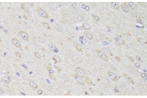 Immunohistochemistry of paraffin-embedded Mouse brain using GANAB Polyclonal Antibody at dilution of 1:150 (40x lens). (GANAB anticorps)