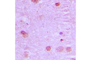 Immunohistochemical analysis of NCOA7 staining in human brain formalin fixed paraffin embedded tissue section.