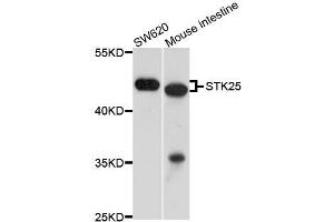Western blot analysis of extracts of various cell lines, using STK25 antibody (ABIN5996002) at 1/1000 dilution. (STK25 anticorps)