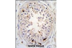 Formalin-fixed and paraffin-embedded human testis tissue reacted with USP2 antibody (C-term ), which was peroxidase-conjugated to the secondary antibody, followed by DAB staining.