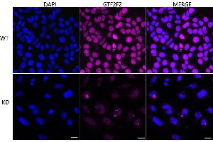 Immunocytochemical staining of HeLa cells using GTF2F2 antibody (ABIN7798708), 1:1,000), Top panel: wild-type (WT), Bottom panal: GTF2F2 shRNA knockdown (KD). (Recombinant GTF2F2 anticorps)