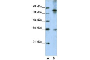 WB Suggested Anti-WNT9B Antibody Titration:  5. (WNT9B anticorps  (C-Term))