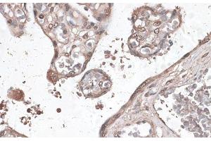 Immunohistochemistry of paraffin-embedded Human placenta using MEF2C Polyclonal Antibody at dilution of 1:100 (40x lens). (MEF2C anticorps)