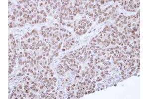 IHC-P Image Immunohistochemical analysis of paraffin-embedded SW480 Xenograft, using NR0B2, antibody at 1:100 dilution.