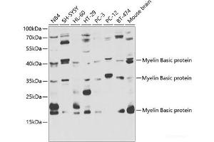 Western blot analysis of extracts of various cell lines using Myelin Basic protein Polyclonal Antibody at dilution of 1:1000. (MBP anticorps)