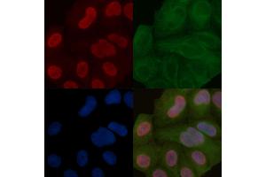 TDRD3 Mouse Monoclonal Antibody staining Hela cells by IF/ICC. (TDRD3 anticorps)