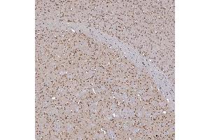 IHC analysis of TRMT61A using anti-TRMT61A antibody (ABIN7599220). (TRMT61A anticorps  (AA 1-289))
