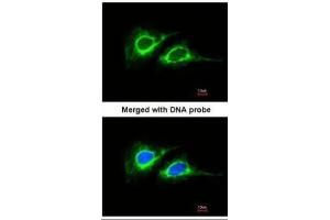 ICC/IF Image Immunofluorescence analysis of paraformaldehyde-fixed HeLa, using Cytokeratin 18 , antibody at 1:200 dilution.