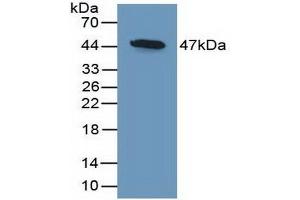 Detection of Recombinant DKK3, Mouse using Polyclonal Antibody to Dickkopf Related Protein 3 (DKK3)