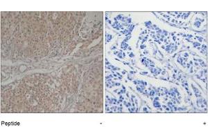 Image no. 1 for anti-SMAD, Mothers Against DPP Homolog 3 (SMAD3) (Ser208) antibody (ABIN319357)