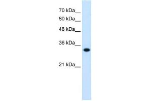 HMGCL antibody used at 0. (HMGCL anticorps)