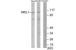 Western blot analysis of extracts from HeLa cells and HUVEC cells, using MKL1 antibody. (MKL1 anticorps  (N-Term))