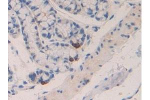Detection of MIP1b in Mouse Intestine Tissue using Polyclonal Antibody to Macrophage Inflammatory Protein 1 Beta (MIP1b) (CCL4 anticorps  (AA 24-92))