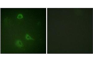 Immunofluorescence staining of methanol-fixed A549 cells using NMDAR1 (Phospho-Ser890) Antibody. (GRIN1/NMDAR1 anticorps  (pSer890))