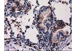 Image no. 5 for anti-Family with Sequence Similarity 127, Member C (FAM127C) antibody (ABIN1498197) (FAM127C anticorps)