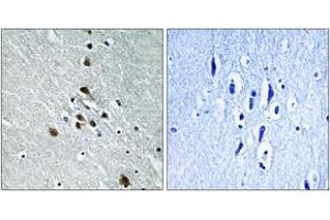 Immunohistochemistry analysis of paraffin-embedded human brain, using SF1 (Phospho-Ser82) Antibody.