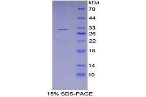 SDS-PAGE (SDS) image for Kallikrein 11 (KLK11) (AA 39-282) protein (His tag) (ABIN2125528) (Kallikrein 11 Protein (KLK11) (AA 39-282) (His tag))