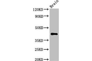 Western Blot Positive WB detected in: Mouse brain tissue All lanes: AGPAT5 antibody at 3. (AGPAT5 anticorps  (AA 174-313))