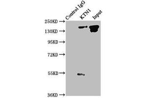 Immunoprecipitating KTN1 in A549 whole cell lysate Lane 1: Rabbit control IgG instead of ABIN7157562 in A549 whole cell lysate. (KTN1 anticorps  (AA 978-1116))