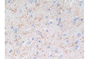 Detection of MMP3 in Human Cerebrum Tissue using Polyclonal Antibody to Matrix Metalloproteinase 3 (MMP3)