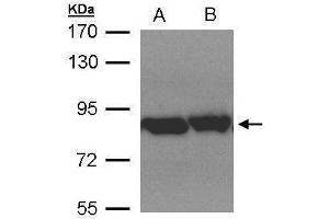 WB Image Sample(30 μg of whole cell lysate) A:Hep G2, B:MOLT4, 7. (TRAP1 anticorps)