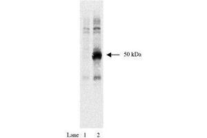 Image no. 1 for anti-HA-Tag antibody (ABIN793576) (HA-Tag anticorps)