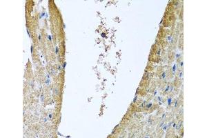 Immunohistochemistry of paraffin-embedded Mouse heart using COX5B Polyclonal Antibody at dilution of 1:100 (40x lens).