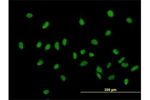 Immunofluorescence of purified MaxPab antibody to ZHX1 on HeLa cell. (ZHX1 anticorps  (AA 1-873))