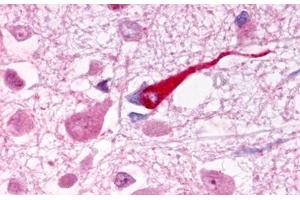 Image no. 1 for anti-Galanin Receptor 1 (GALR1) (Extracellular Domain) antibody (ABIN1048642)