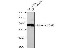Western blot analysis of extracts of various cell lines, using Kininogen 1 (KNG1) antibody (ABIN3022363, ABIN3022364, ABIN3022365 and ABIN6218762) at 1:500 dilution. (KNG1 anticorps  (AA 148-427))