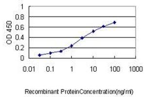 Detection limit for recombinant GST tagged KNTC2 is approximately 0.
