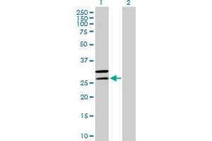 Western Blot analysis of MRPL2 expression in transfected 293T cell line by MRPL2 MaxPab polyclonal antibody. (MRPL2 anticorps  (AA 1-305))