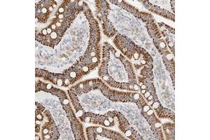 Immunohistochemical staining of human duodenum with CXorf58 polyclonal antibody  strong cytoplasmic positivity in glandular cells at 1:50-1:200 dilution. (CXorf58 anticorps)