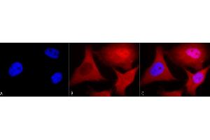 Immunocytochemistry/Immunofluorescence analysis using Mouse Anti-Ubiquitin Monoclonal Antibody, Clone 6C11-B3 (ABIN361817 and ABIN361816).