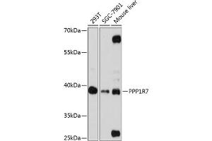 Western blot analysis of extracts of various cell lines, using PPP1R7 antibody (ABIN6132827, ABIN6146072, ABIN6146074 and ABIN6216881) at 1:3000 dilution. (PPP1R7 anticorps  (AA 281-360))