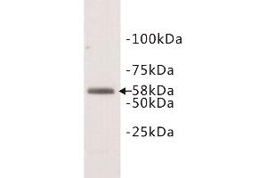 Western Blotting (WB) image for anti-Deoxynucleotidyltransferase, terminal (DNTT) (N-Term) antibody (ABIN1854984) (TdT anticorps  (N-Term))