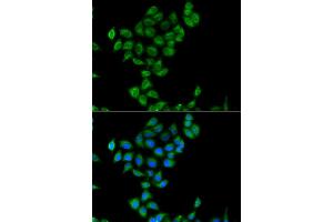Immunofluorescence analysis of  cells using COQ3 antibody (ABIN6133353, ABIN6138894, ABIN6138895 and ABIN6223356). (COQ3 anticorps  (AA 50-369))