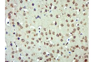 Paraformaldehyde-fixed, paraffin embedded Mouse brain Antigen retrieval by boiling in sodium citrate buffer (pH6.