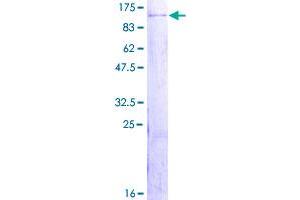 Image no. 1 for Zinc Finger and BTB Domain Containing 48 (ZBTB48) (AA 1-688) protein (GST tag) (ABIN1325618)
