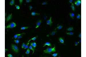 Immunofluorescent analysis of U251 cells using ABIN7173253 at dilution of 1:100 and Alexa Fluor 488-congugated AffiniPure Goat Anti-Rabbit IgG(H+L) (TMEM61 anticorps  (AA 90-210))