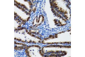 Immunohistochemistry of paraffin-embedded rat fallopian tube using HSPH1 antibody (ABIN2563287) at dilution of 1:100 (40x lens). (HSPH1 anticorps)