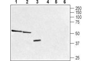 Western blot analysis of rat liver (lane 1 and 4), mouse kidney (lanes 2 and 5) and human brain glioblastoma (U-87) cell (lanes 3 and 6) lysates: - 1-3. (TAAR1 anticorps  (C-Term, Intracellular))