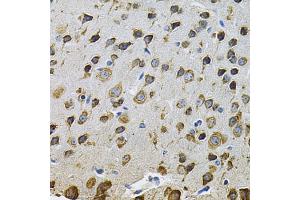 Immunohistochemistry of paraffin-embedded rat brain using NCF4 Antibody (ABIN5971122) at dilution of 1/100 (40x lens). (NCF4 anticorps)