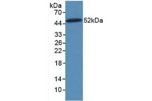 Detection of Recombinant VIM, Human using Monoclonal Antibody to Vimentin (VIM)