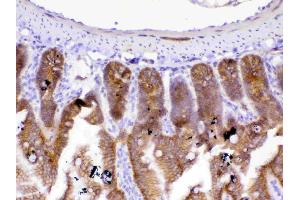 IHC analysis of beta Catenin using anti-beta Catenin antibody .