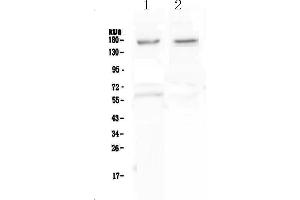 Western blot analysis of Neurexin 1 using anti-Neurexin 1 antibody . (Neurexin 1 anticorps  (AA 141-294))