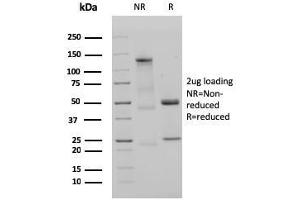 SDS-PAGE Analysis Purified IgM Recombinant Rabbit Monoclonal Antibody (IGHM/3135R). (Recombinant IGHM anticorps)