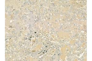 ABIN6264521 and ABIN6276992 at 1/100 staining human normal lung tissue by IHC-P.
